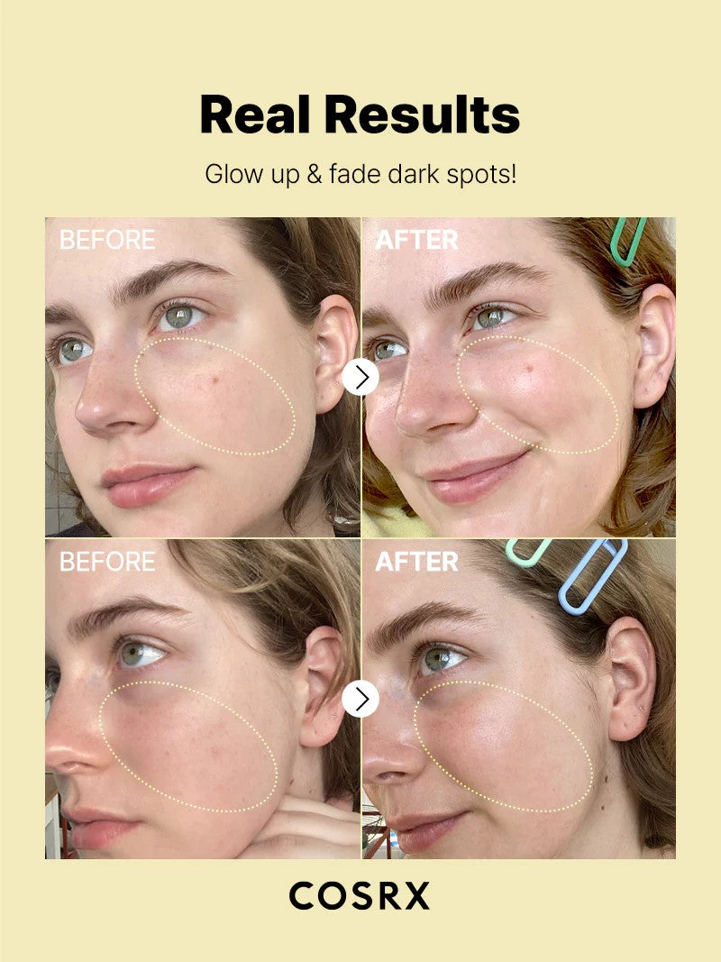 سيروم فيتامين سي 23 COSRX The Vitamin C 23 Serum