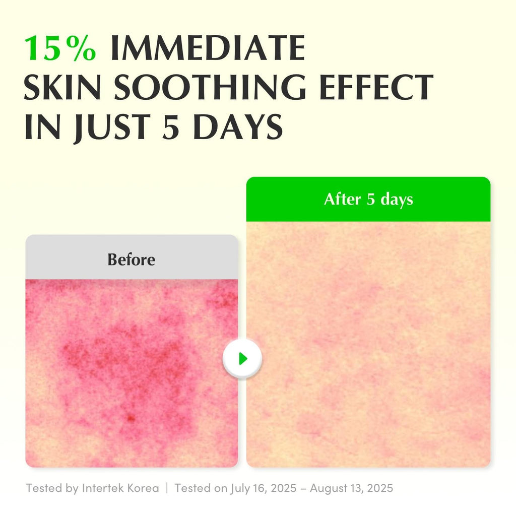 EQQUAL BERRY Green Aid Aloe PDRN Calming Serum 30 ml | ايكوال بيري سيروم الوفيرا للترميم