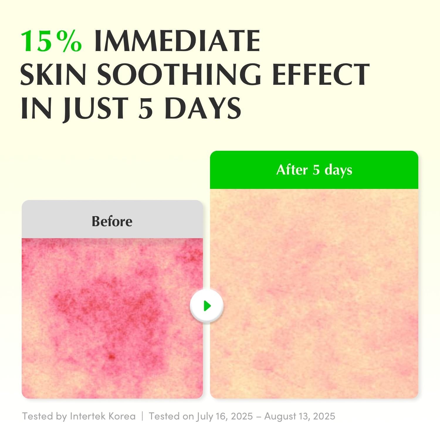 EQQUAL BERRY Green Aid Aloe PDRN Calming Serum 30 ml | ايكوال بيري سيروم الوفيرا للترميم