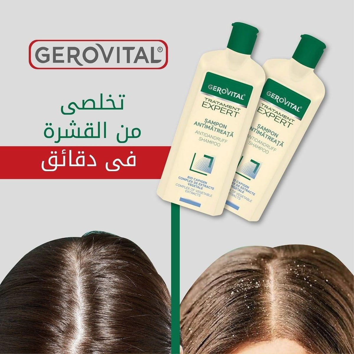شامبو معالج للقشرة والحكة من جيروفيتال | Gerovital Anti-Dandruff & Itch Shampoo