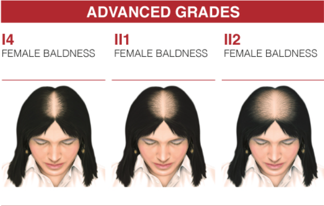 CRESCINA Transdermic HFSC Complete Treatment 1300 - 3.5x10+10 | كريشنا أمبولات ضد تساقط الشعر للنساء عيار 1300 - 3.5 مل