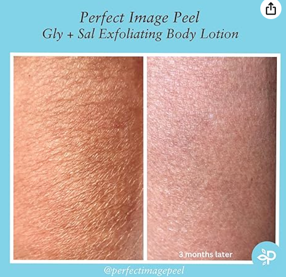 Perfect Image Gly + Sal Exfoliating Body Lotion - 240ml | بيرفكت إيمج لوشن ساليسيليك + غليكوليك اسيد للجسم - 240 مل
