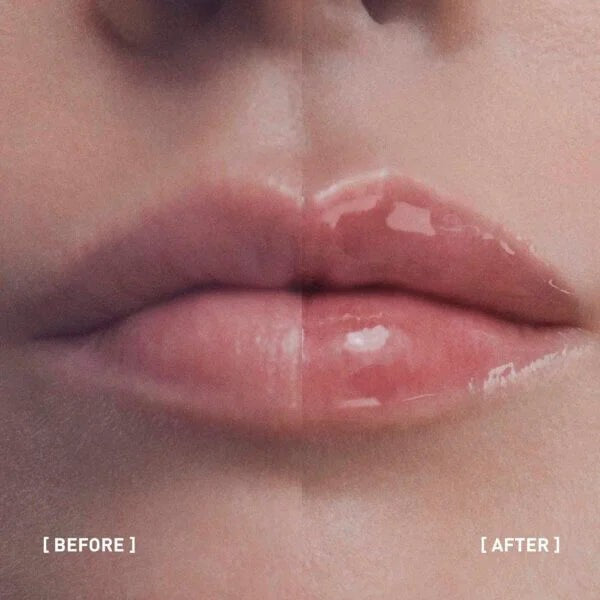 FILORGA Hyalu-Filler Lips - 4g | فيلورغا هايالو-فيلر شفايف - 4 جرام