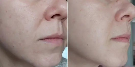 Pixi Retinol Tonic | بيكسي تونر ريتينول