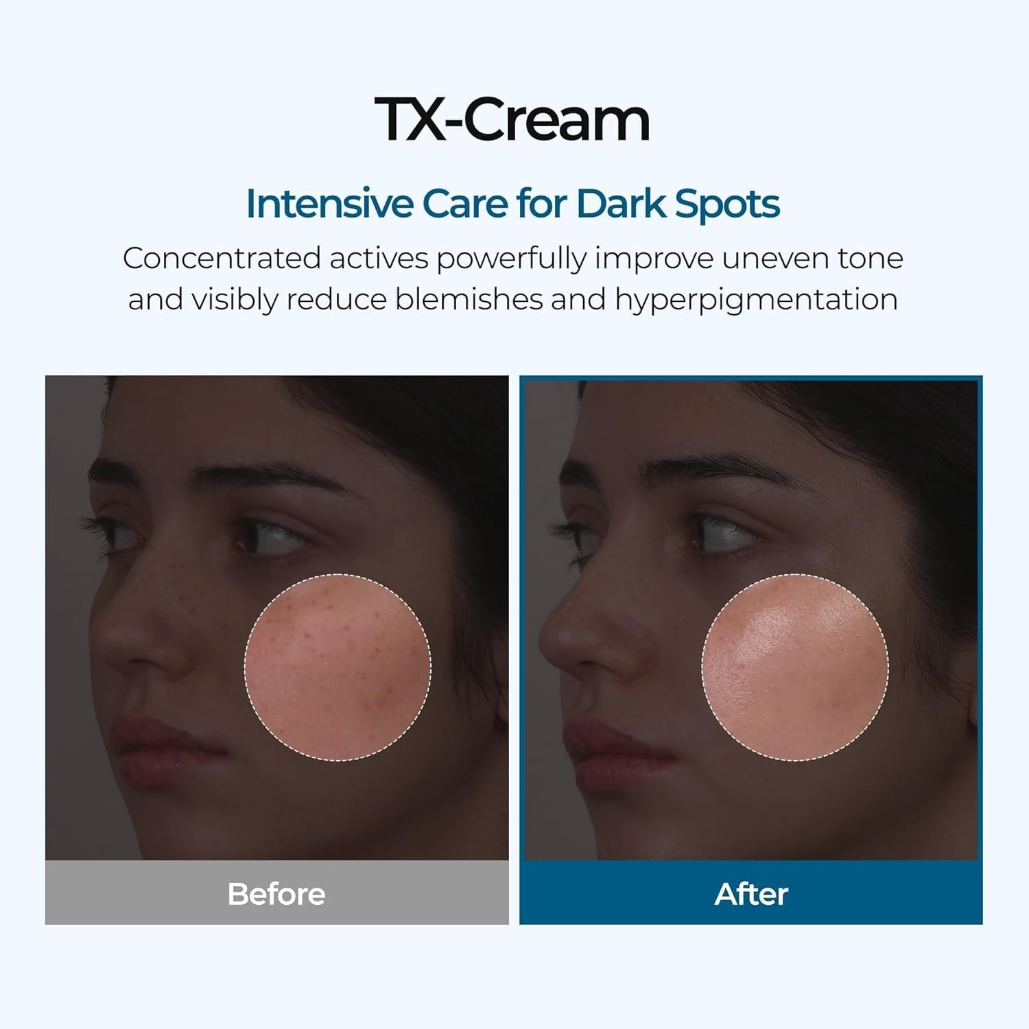 Dr.Melaxin TX Cream - 50g| د. ميلاكسن كريم لتفتيح وتوحيد لون البشرة – 50 غرام