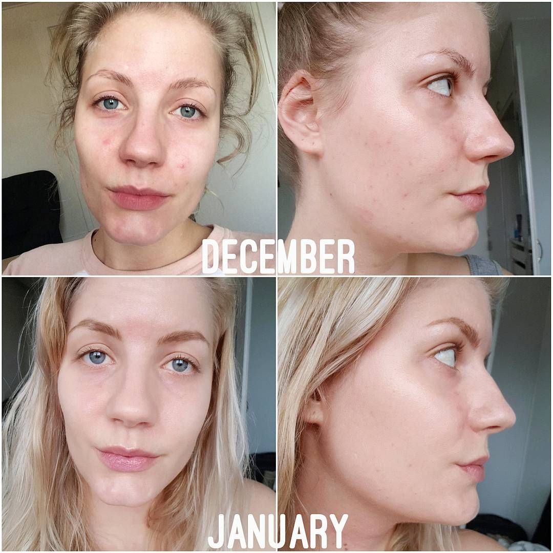 The Ordinary Niacinamide 10% + Zinc 1% - 60ml | ذا اورديناري سيروم نياسيناميد 10% مع الزنك 1% - 60 مل