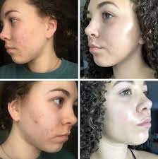 Cerave Sa Smoothing Cleanser - 236ml | سيرافي غسول منعم للبشرة - 236 مل