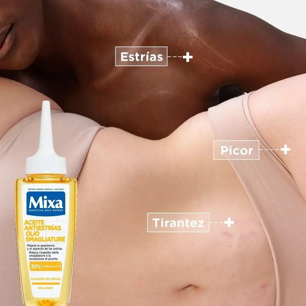 MIXA ACEITE ANTIESTRÍAS OLIO SMAGLIATURE زيت مضاد لعلامات التمدد