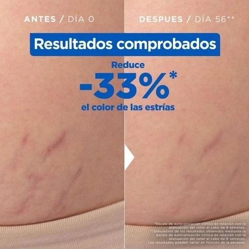 MIXA ACEITE ANTIESTRÍAS OLIO SMAGLIATURE زيت مضاد لعلامات التمدد