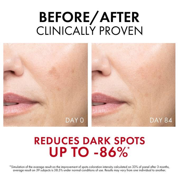 VICHY Liftactiv Pigment Specialist B3 Anti-dark Spots Serum 30ml ڤيچي سيروم مكافح للبقع الداكنة وموحد للون البشرة