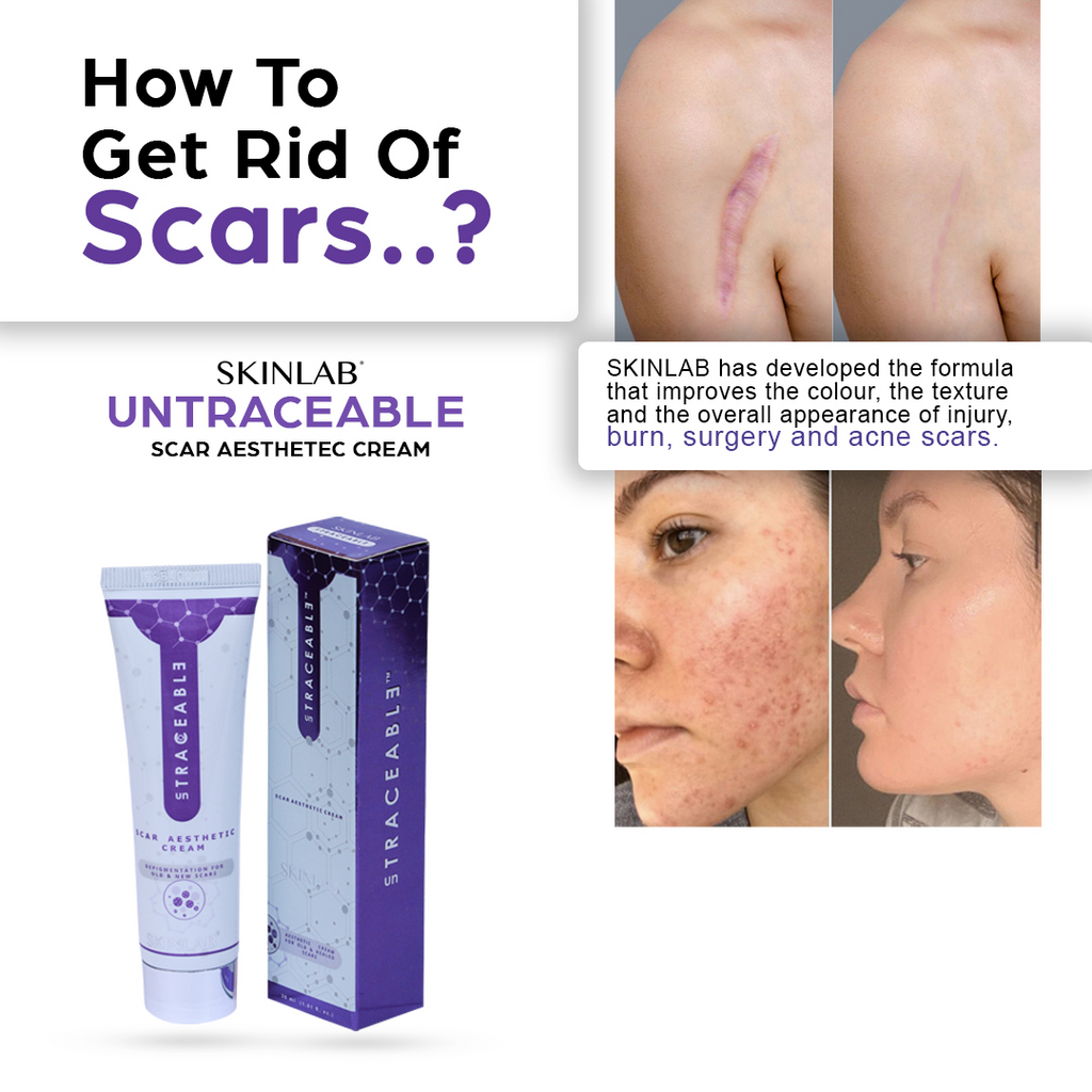 Skinlab Stracell Scar Aesthetic Cream – 30ml | سكين لاب ستراسيل كريم لتحسين مظهر الندبات – 30 مل