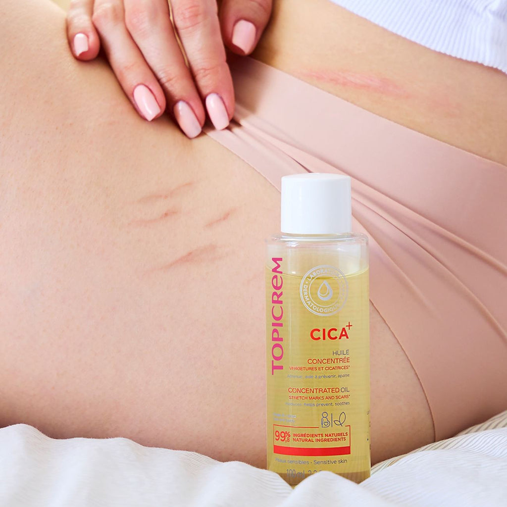 Topicrem CICA+ Concentrated Oil for Stretch Marks & Scars – 100ml | توبيكريم زيت مركز للعناية بعلامات التمدد والندبات وترطيب البشرة – 100 مل