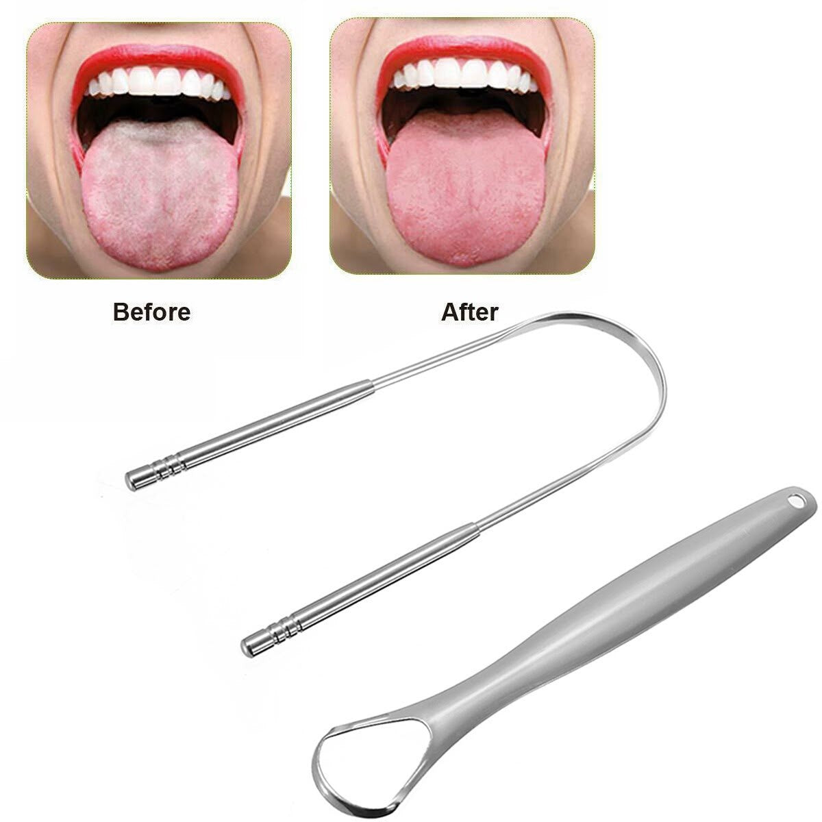 i Tooth Super Tongue Scraper Stainless Steel Dual-Action | اي توث كاشط لسان مزدوج من الستانلس ستيل لتنظيف اللسان وتقليل رائحة الفم